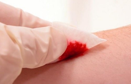 Comer gelatina ajuda a cicatrizar as feridas