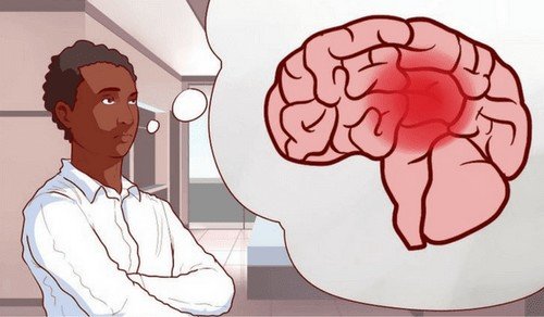 7 hábitos que você deve evitar porque afetam sua saúde cerebral