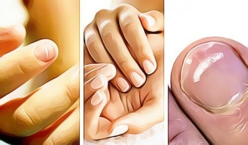 5 sinais emitidos pelas unhas das mãos