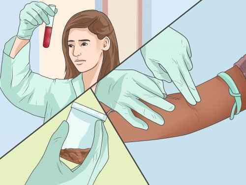 7 sinais precoces de câncer colorretal que não se deve negligenciar