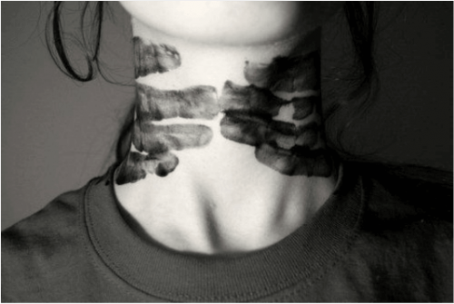 marcas-maos-no-pescoco