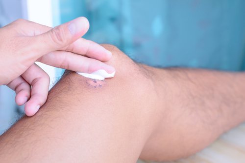 As feridas podem se tornar difíceis de curar devido a deficiência de vitamina C