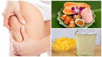 Minimize o aspecto da celulite com estes 5 remédios naturais