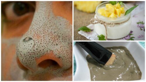 Quer ter uma pele bonita e livre de cravos? Experimente estas máscaras Quer ter uma pele bonita e livre de cravos? Experimente estas máscaras