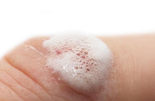 Água oxigenada para feridas