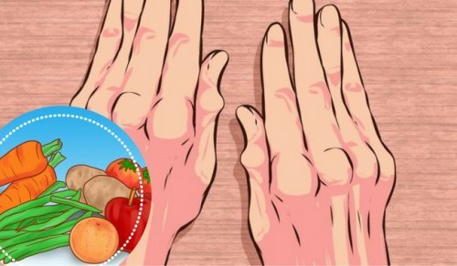 Sofre de artrite? Inclua estes alimentos na dieta