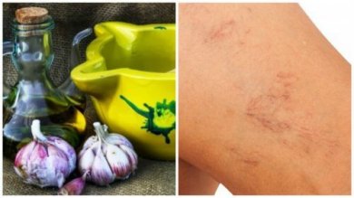 Tratamento de azeite de oliva e alho para combater as varizes