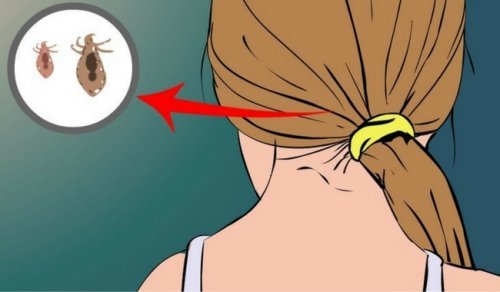 Como combater os piolhos naturalmente