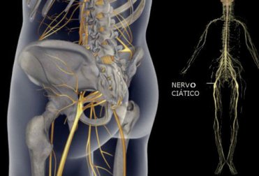 Exercícios simples para aliviar a dor no nervo ciático, das costas e do quadril