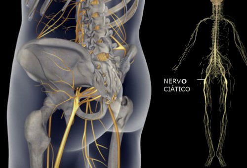 Exercícios simples para aliviar a dor no nervo ciático, das costas e do quadril