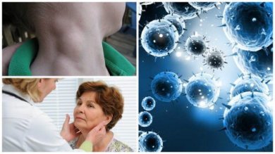Linfoma, um câncer silencioso que pode ser tratado com êxito se detectado a tempo