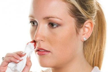 Remédios naturais para combater o sangramento nasal