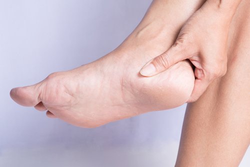 Como curar o esporão de calcâneo de forma natural