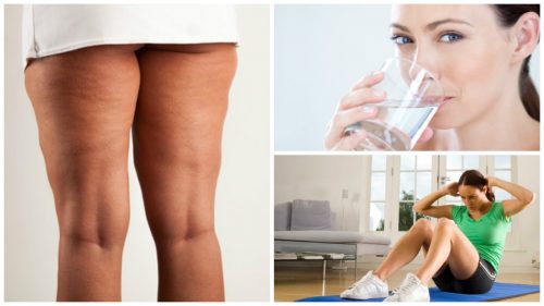 6 coisas que você deve fazer antes de iniciar um tratamento contra a celulite 6 coisas que você deve fazer antes de iniciar um tratamento contra a celulite