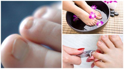 7 fatos sobre os fungos nas unhas que você deve conhecer