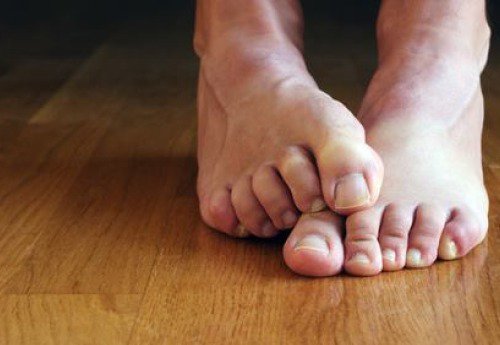 Os fungos nas unhas são contagiosos