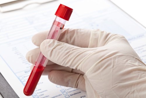 Exame de sangue para detectar triglicerídeos