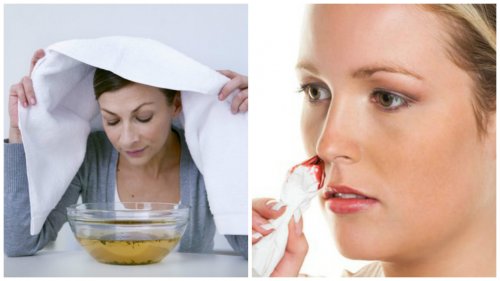 7 soluções caseiras eficazes contra as hemorragias nasais