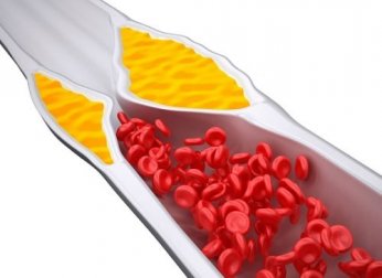 4 shakes para controlar o seu colesterol