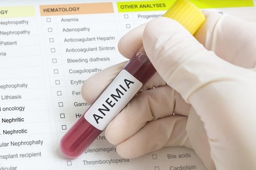 Exame de anemia, que pode ser evitado com salsa