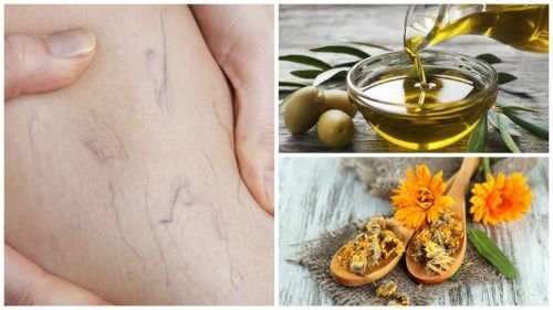 Combata as varizes com este tratamento de azeite de oliva e calêndula