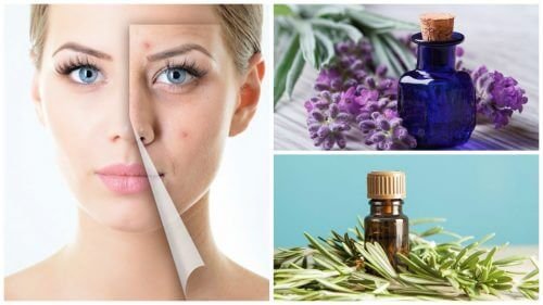 Limpe a acne da pele com estes 6 óleos essenciais