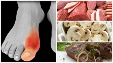 Você sofre com a gota? Conheça 8 alimentos para evitar em sua dieta
