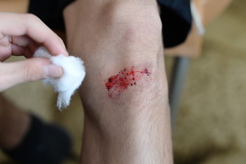 cicatrizacao-lenta