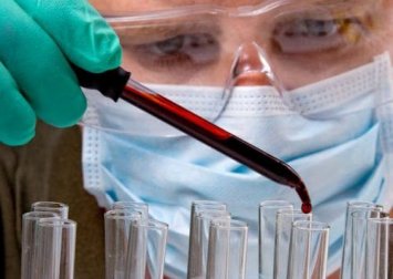 Um simples exame de sangue poderia localizar onde estão os tumores