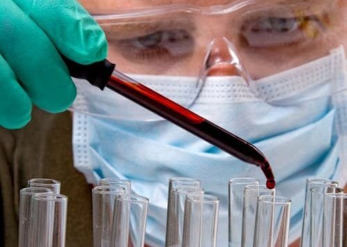 Um simples exame de sangue poderia localizar onde estão os tumores