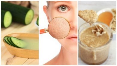 Poros dilatados: 5 remédios naturais que ajudam a fechá-los