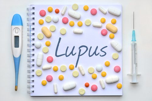 Caderno escrito com a palavra lupus