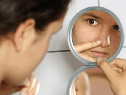 mulher com acne