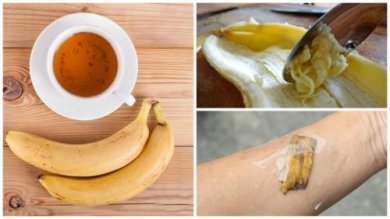 5 formas de usar as cascas de banana como remédio natural