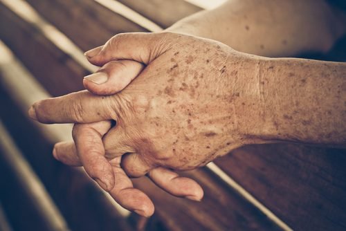 4 remédios caseiros que evitam as manchas da idade