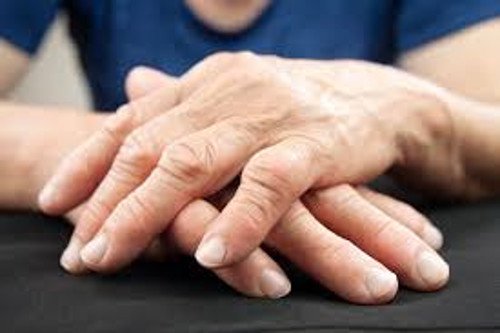 Mãos deformes por causa de um pH ácido