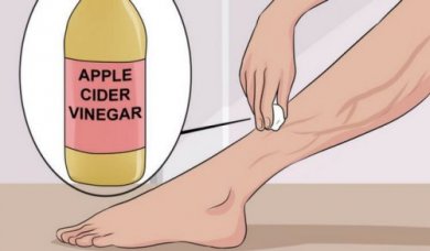Trate as varizes com aloe vera, cenoura e vinagre de maçã