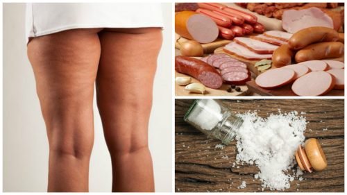 A celulite: 7 alimentos para serem evitados