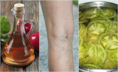 Combata as varizes com um tratamento caseiro de vinagre e tomate verde