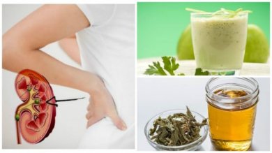 Como combater cálculos renais de forma natural com 5 remédios