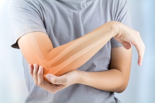 5 alimentos para prevenir a artrose