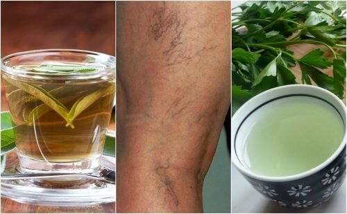 5 infusões para combater as varizes