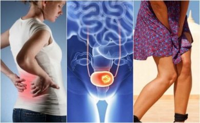 Câncer de bexiga: 7 sinais que devemos ficar atentos