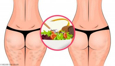 Como eliminar a celulite com uma dieta saudável