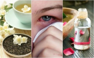 Como tratar as infecções oculares com 5 remédios naturais