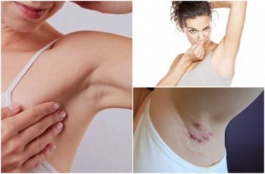 5 sinais de advertência que suas axilas dão sobre sua saúde