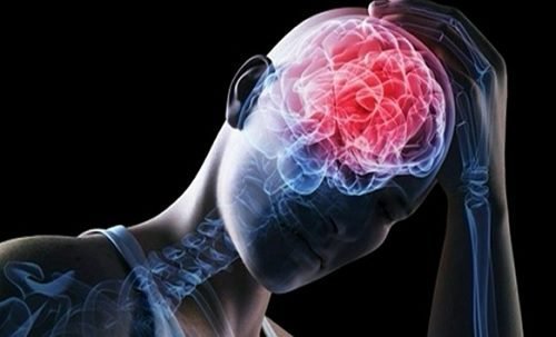 Outra das doenças cerebrovasculares mais comuns é a embolia cerebral