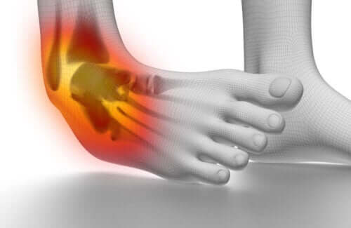 6 dicas para prevenir e tratar torções de tornozelo