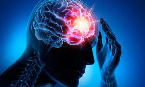 As 4 doenças cerebrovasculares mais comuns