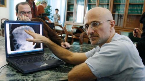 Médico mostrando uma cabeça